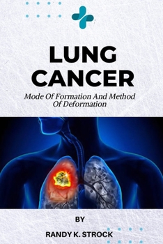 Paperback Lung Cancer: Mode Of Formation and Method of Deformation Book