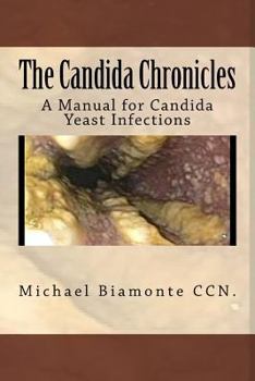 Paperback The Candida Chronicles: A Mannual for Candida/Yeast Infections Book