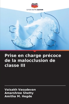 Paperback Prise en charge précoce de la malocclusion de classe III [French] Book