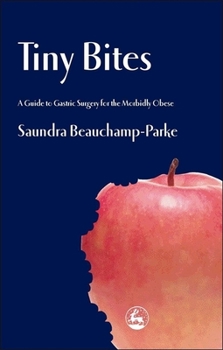 Paperback Tiny Bites: A Guide to Gastric Surgery for the Morbidly Obese Book