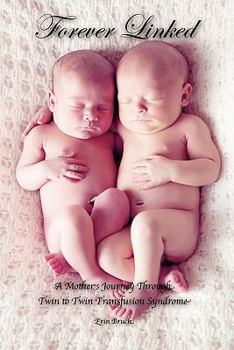 Paperback Forever Linked: A Mother's Journey Through Twin to Twin Transfusion Synrome Book
