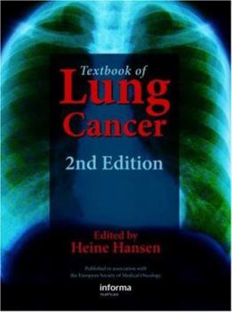 Hardcover Textbook of Lung Cancer Book