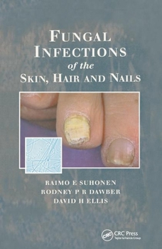 Paperback Fungal Infections of the Skin and Nails Book