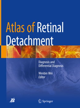 Hardcover Atlas of Retinal Detachment: Diagnosis and Differential Diagnosis Book