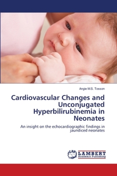 Paperback Cardiovascular Changes and Unconjugated Hyperbilirubinemia in Neonates Book