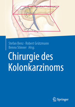 Hardcover Chirurgie Des Kolonkarzinoms [German] Book