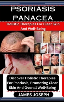 Paperback Psoriasis Panacea: Holistic Therapies For Clear Skin And Well-Being: Discover Holistic Therapies For Psoriasis, Promoting Clear Skin And Book