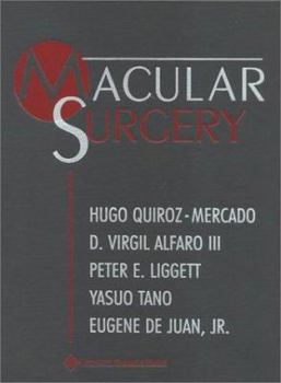 Macular Surgery