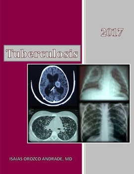 Paperback Tuberculosis 2017: English Edition Book