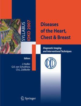 Paperback Diseases of the Heart, Chest & Breast: Diagnostic Imaging and Interventional Techniques Book
