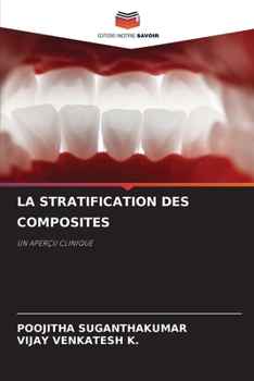 LA STRATIFICATION DES COMPOSITES: UN APERÇU CLINIQUE (French Edition)