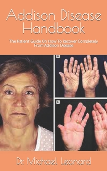 Paperback Addison Disease Handbook: The Patient Guide On How To Recover Completely From Addison Disease Book