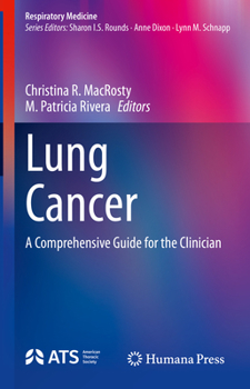 Hardcover Lung Cancer: A Comprehensive Guide for the Clinician Book