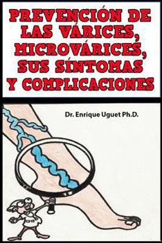 Paperback Prevencion de las Varices, Microvarices, Sus sintomas y complicaciones: (b & W) [Spanish] Book
