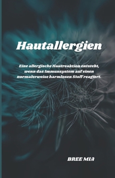 Hautallergien: Eine allergische Hautreaktion entsteht, wenn das Immunsystem auf einen normalerweise harmlosen Stoff reagiert.