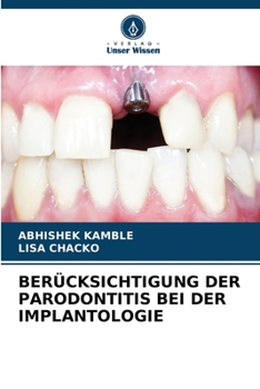 Paperback Berücksichtigung Der Parodontitis Bei Der Implantologie [German] Book