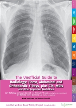 Paperback Unofficial Guide to Radiology: Chest, Abdominal and Orthopaedic X Rays, Plus Cts, Mris and Other Important Modalities: Core Radiology Curriculum Book