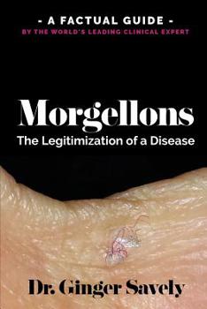 Paperback Morgellons: The legitimization of a disease: A Factual Guide by the World's Leading Clinical Expert Book