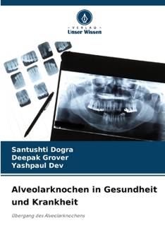 Paperback Alveolarknochen in Gesundheit und Krankheit [German] Book