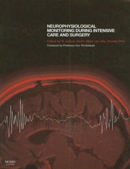 Neurophysiological Monitoring During Intensive Care and Surgery