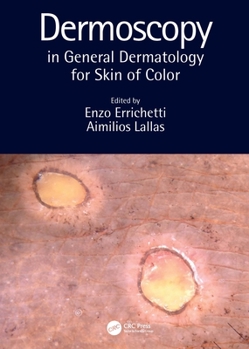 Hardcover Dermoscopy in General Dermatology for Skin of Color Book