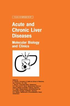 Hardcover Acute and Chronic Liver Diseases: Molecular Biology and Clinics Book
