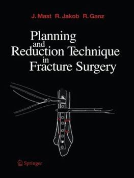 Paperback Planning and Reduction Technique in Fracture Surgery Book