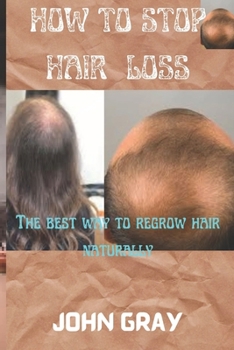 Paperback How to stop hair loss: The best way to regrow hair naturally Book