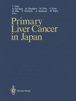 Paperback Primary Liver Cancer in Japan Book