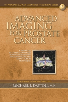 Paperback Advanced Imaging for Prostate Cancer: A Primer on 3D Color-Flow Power Doppler Ultrasound, Multiparametric MRI and CT Fusion Techniques Book