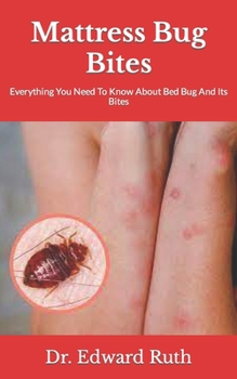 Paperback Mattress Bug Bites: Everything You Need To Know About Bed Bug And Its Bites Book