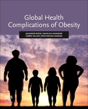 Paperback Global Health Complications of Obesity Book