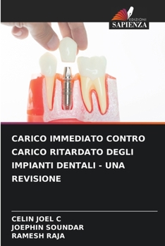 Paperback Carico Immediato Contro Carico Ritardato Degli Impianti Dentali - Una Revisione [Italian] Book