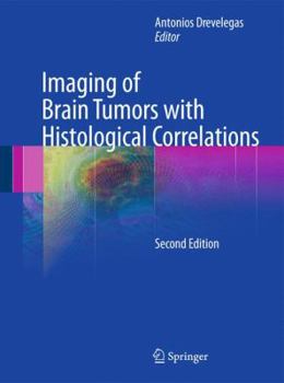 Imaging of Brain Tumors with Histological Correlations