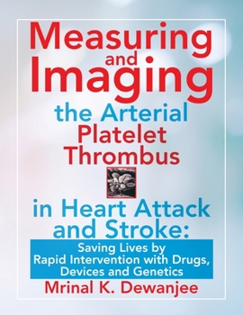 Paperback Measuring and Imaging the Arterial Platelet Thrombus in Heart Attack and Stroke: Saving Lives by Rapid Intervention with Drugs, Devices and Genetics Book