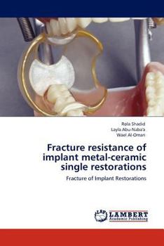 Paperback Fracture Resistance of Implant Metal-Ceramic Single Restorations Book