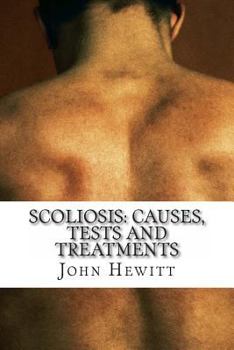 Paperback Scoliosis: Causes, Tests and Treatments Book