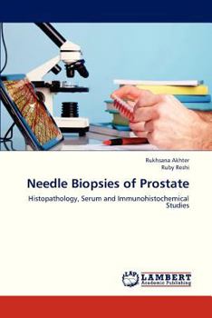 Paperback Needle Biopsies of Prostate Book