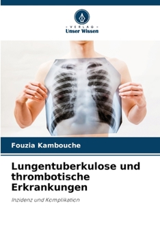 Paperback Lungentuberkulose und thrombotische Erkrankungen [German] Book