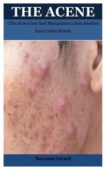 Paperback The Acene: (The Acne Cure And Maintainers) Just Another Four Letter Words Book