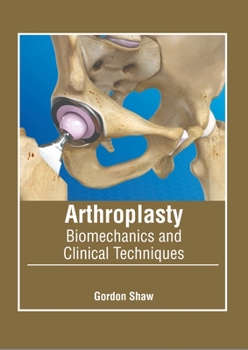 Hardcover Arthroplasty: Biomechanics and Clinical Techniques Book
