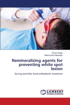 Paperback Remineralizing agents for preventing white spot lesion Book