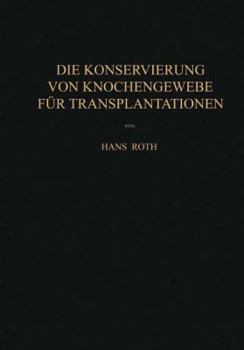 Paperback Die Konservierung Von Knochengewebe Für Transplantationen [German] Book