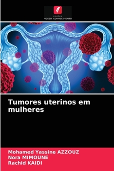 Paperback Tumores uterinos em mulheres [Portuguese] Book