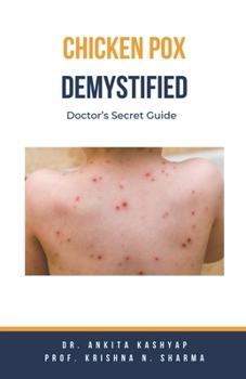 Paperback Chickenpox Demystified: Doctor's Secret Guide Book