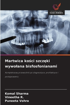 Martwica kosci szczeki wywolana bisfosfonianami (Polish Edition)