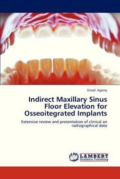 Paperback Indirect Maxillary Sinus Floor Elevation for Osseoitegrated Implants Book