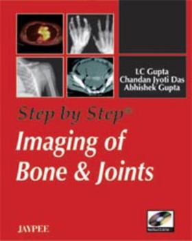 Hardcover Step by Step: Imaging of Bone and Joints Book