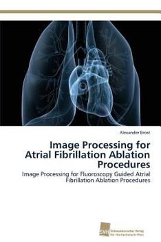 Paperback Image Processing for Atrial Fibrillation Ablation Procedures Book