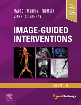 Hardcover Image-Guided Interventions: Expert Radiology Series Book